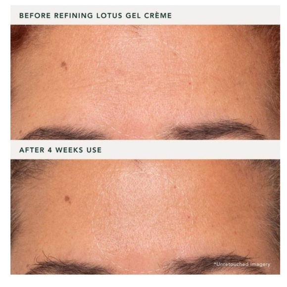 🆕 RANAVAT Refining Lotus Gel Crème 50 mL NIB - Picture 5 of 6